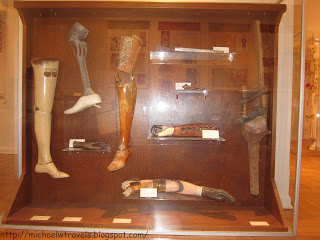 a display of prosthetic legs