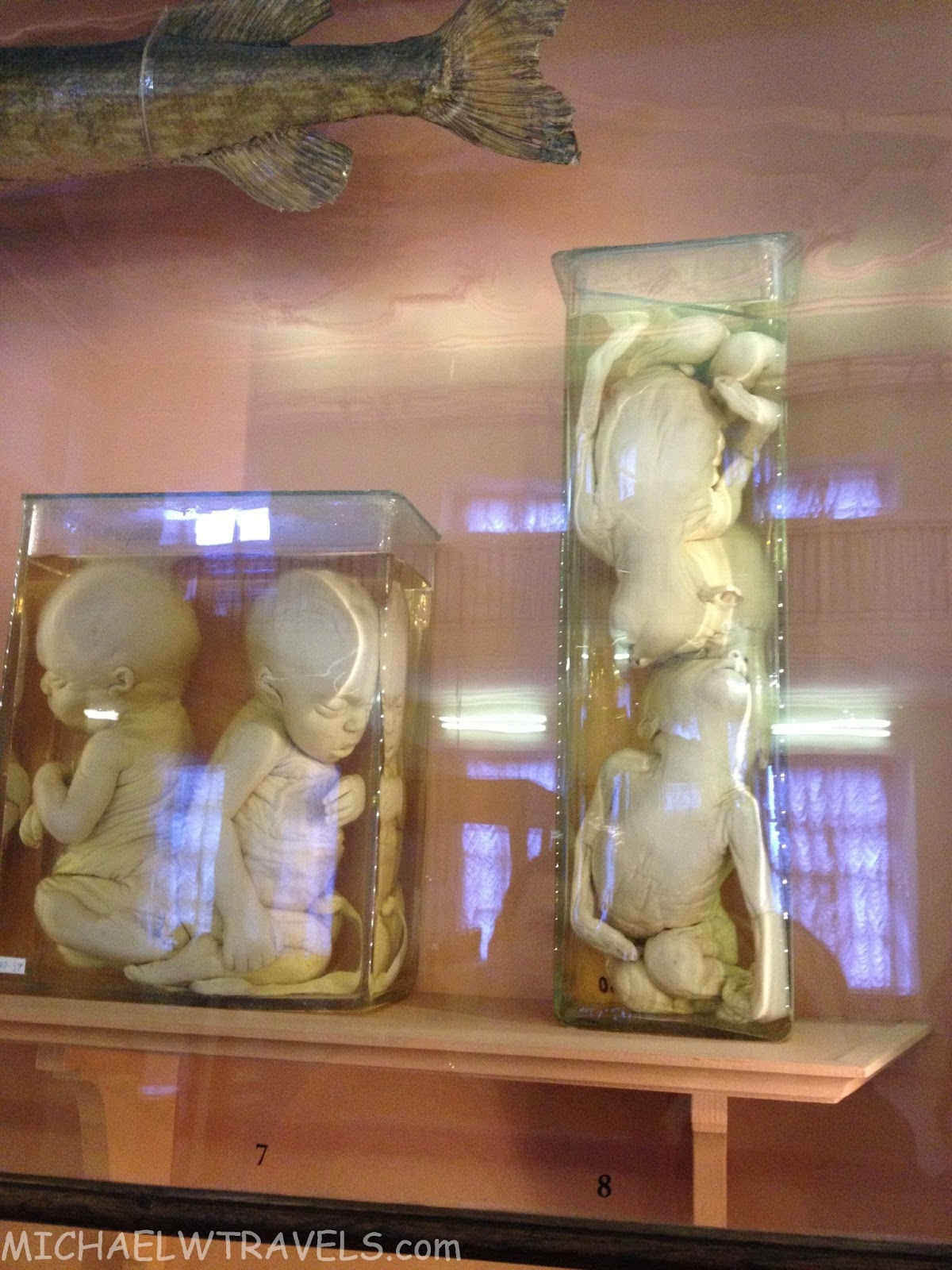 A Shocking Collection Of Oddities: The Kunstkamera- St Petersburg Russia